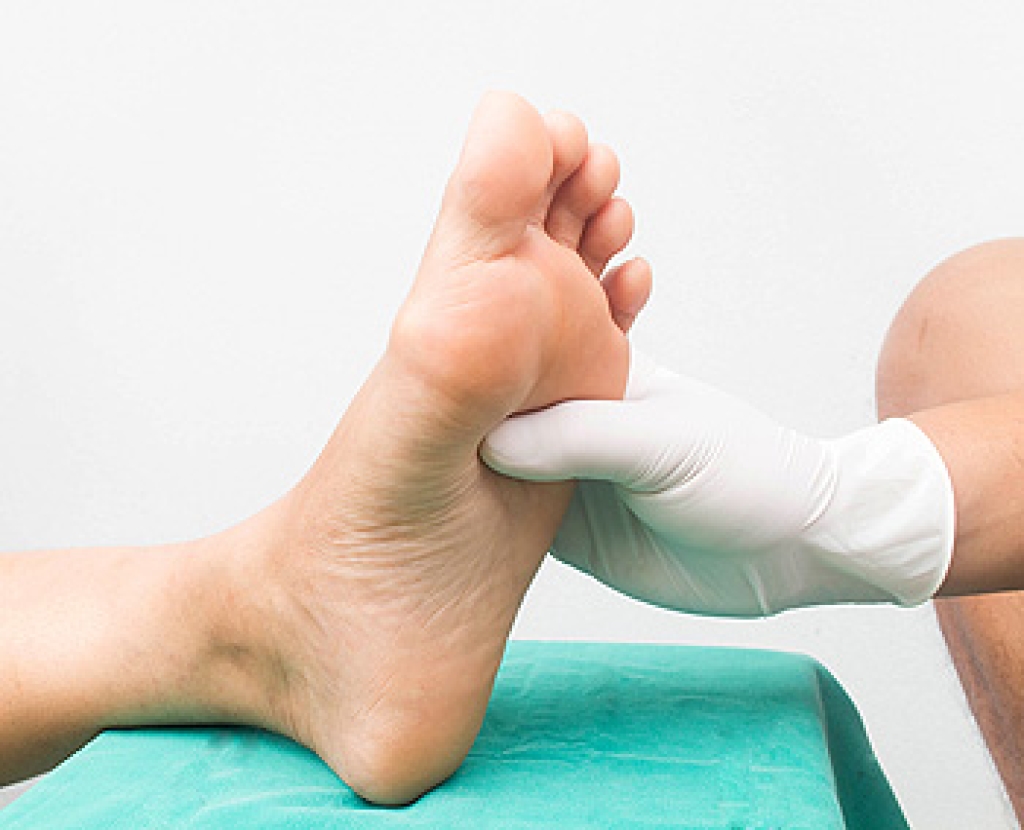 Facts About Peripheral Neuropathy in the Feet