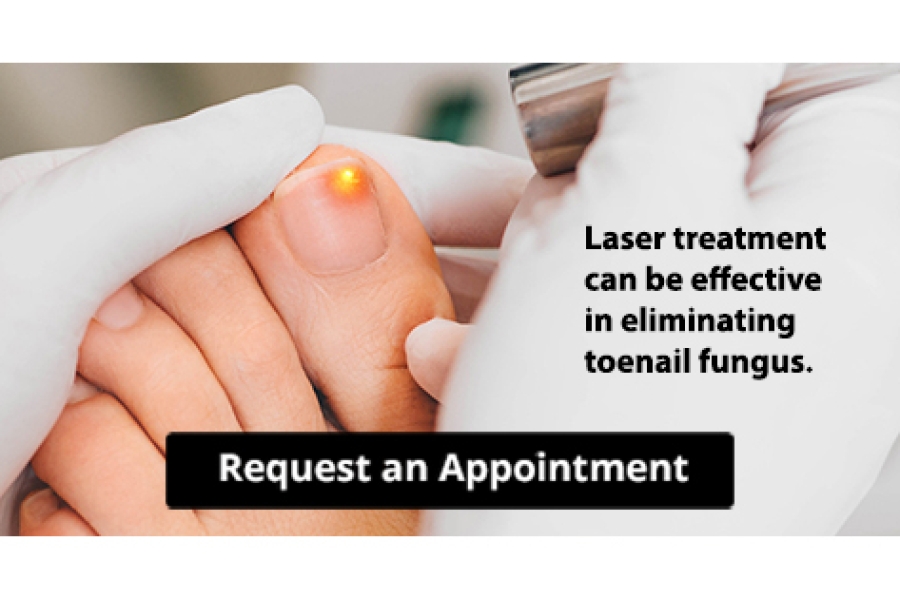Best At Home Toenail Fungus Laser Try Laser Treatment For Toenail Fungus