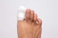How to Manage a Broken Toe